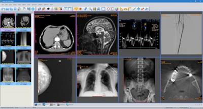 Sante DICOM Editor v10.0.2 永久破解版下載 crack